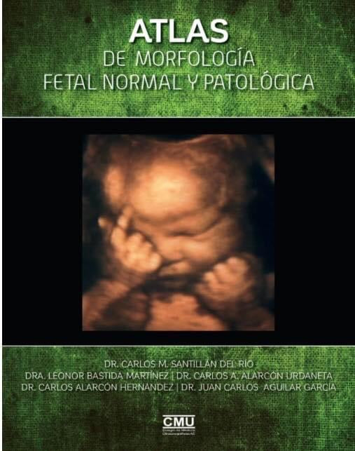 Atlas de morfología fetal normal y patológica